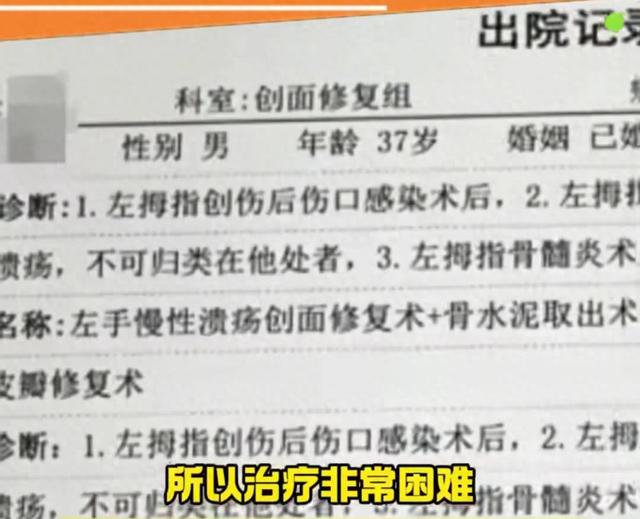 男子手指被人咬伤险截肢，获赔几十万