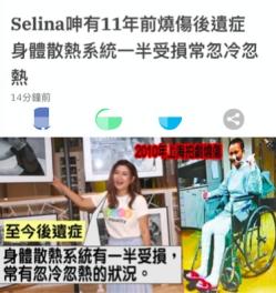 Selina再谈烧伤事故，自曝康复期像坐牢，体温至今冷热骤变